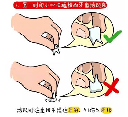 牙外伤01.jpg