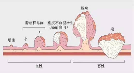 https://timgsa.baidu.com/timg?image&quality=80&size=b9999_10000&sec=1555651483876&di=f28fdfc019a57066ab97c43c1af1b58b&imgtype=0&src=http%3A%2F%2Fwww.novogene.com%2Fupload%2Fimage%2F20161103%2F20161103180207_96695.jpg