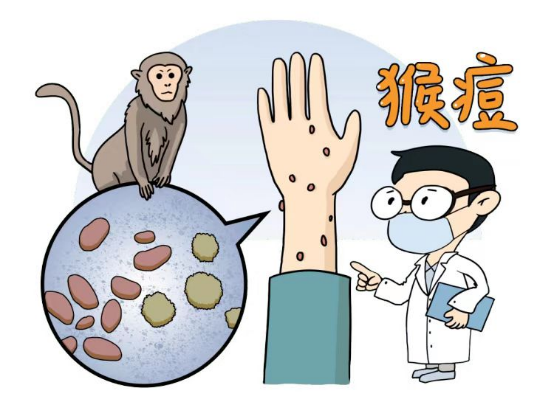 猴痘2.png